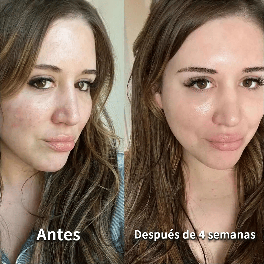 MASCARILLA DE COLÁGENO X5 UNDS🌟 COLLAGEN MIRACLE™ : Reafirma y reduce arrugas con colágeno hidrolizado de alto impacto.