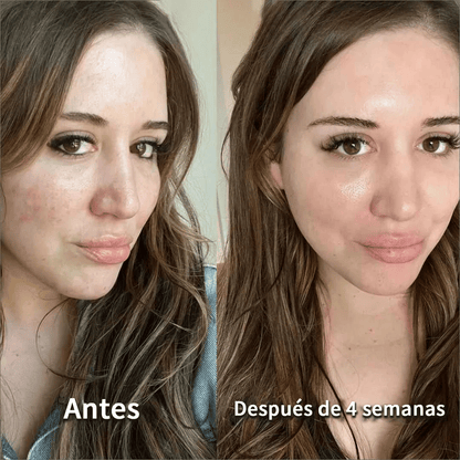 MASCARILLA DE COLÁGENO X5 UNDS🌟 COLLAGEN MIRACLE™ : Reafirma y reduce arrugas con colágeno hidrolizado de alto impacto.
